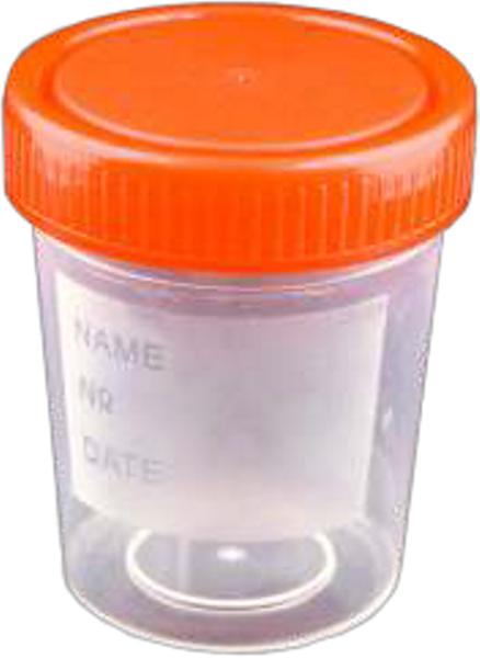 Urine Container 60 ml